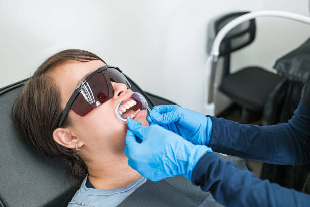 Best Emergency Wisdom Tooth Extraction in South Houston, TX